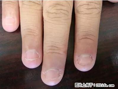 剪指甲、挖耳屎，这些日常小动作竟隐藏大危害！ - 大庆生活资讯 - 大庆28生活网 dq.28life.net